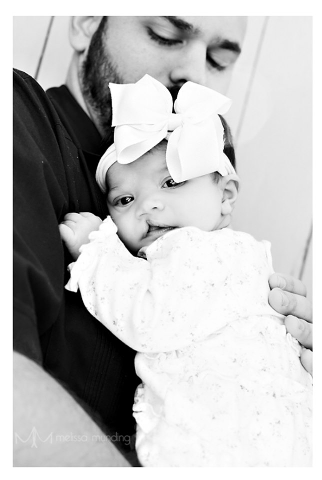 Newborn Photography of Baby Girl with Cleft Lip in her daddy's arms with large bow on her head